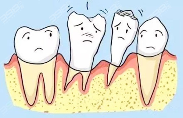 牙周炎导致牙槽骨吸收可以恢复吗
