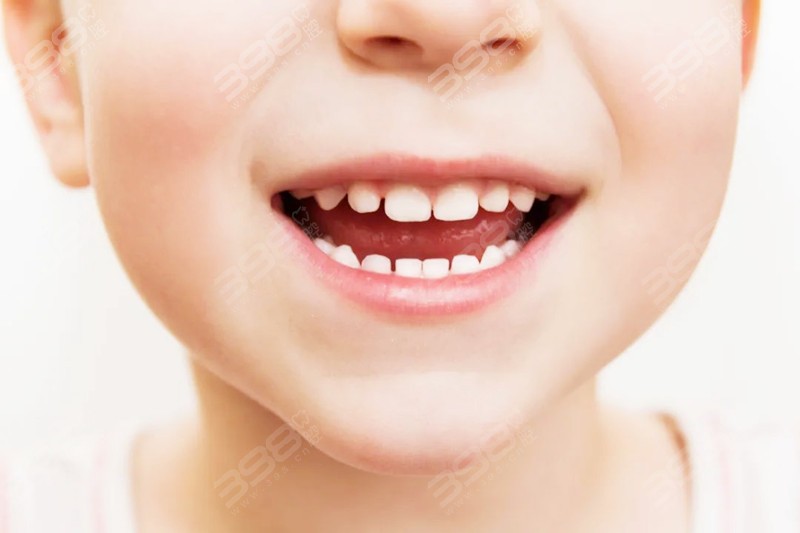 孩子多大可以用牙线