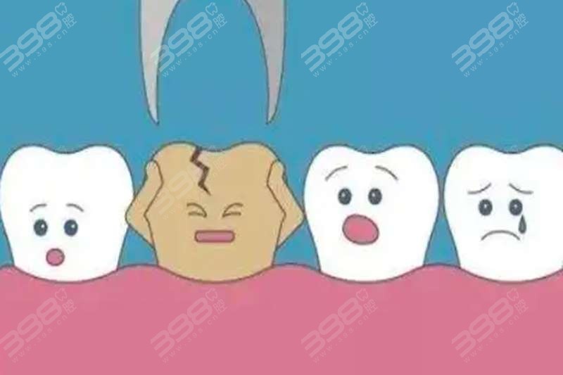 孝感口腔医院补牙、补牙、洗牙多少钱