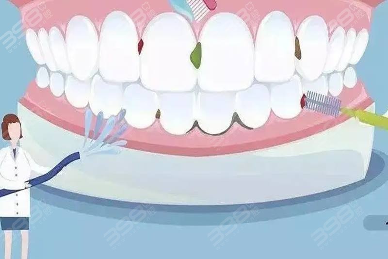 为什么医生不推荐洗牙