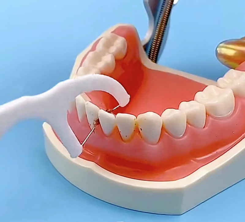 牙线的正确使用方法快码住，这下就明白牙线要进入牙龈沟吗