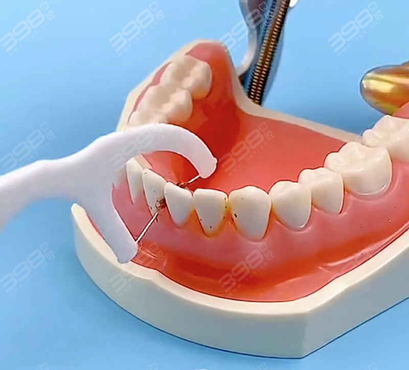 牙线的正确使用方法