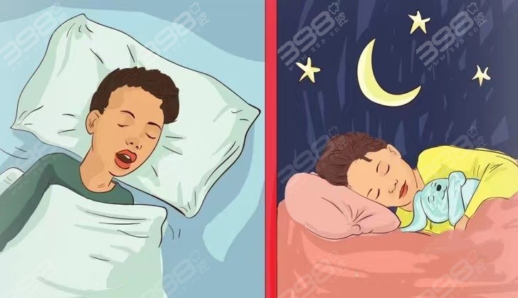 张嘴睡觉和口呼吸是一回事吗