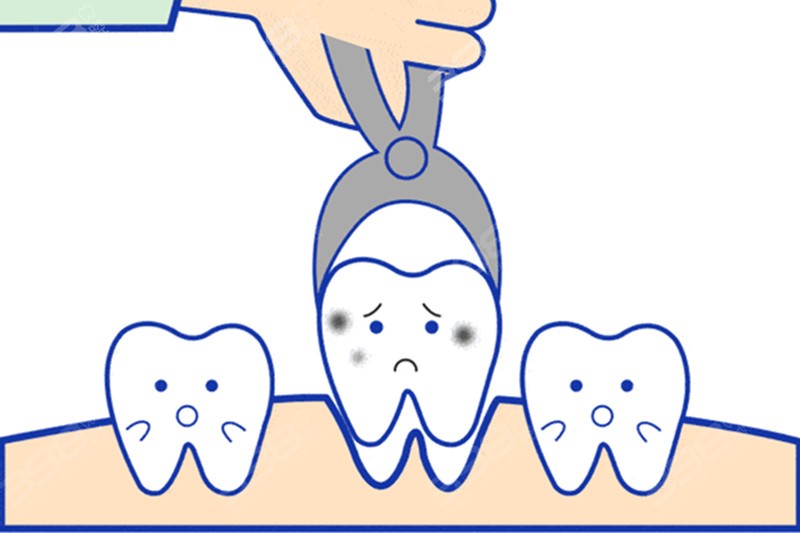 牙洞的护理小知识