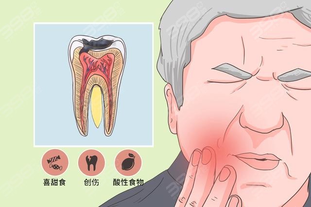 牙髓受到刺激导致牙痛