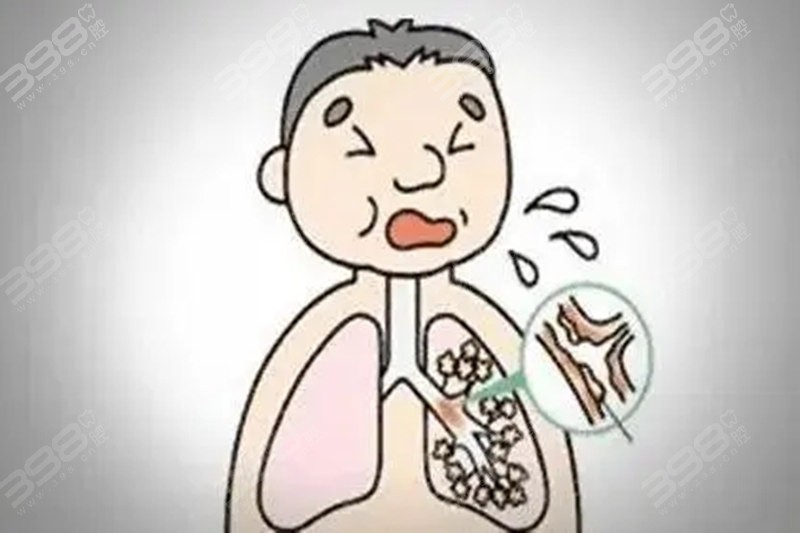 呼吸系统疾病会导致口臭
