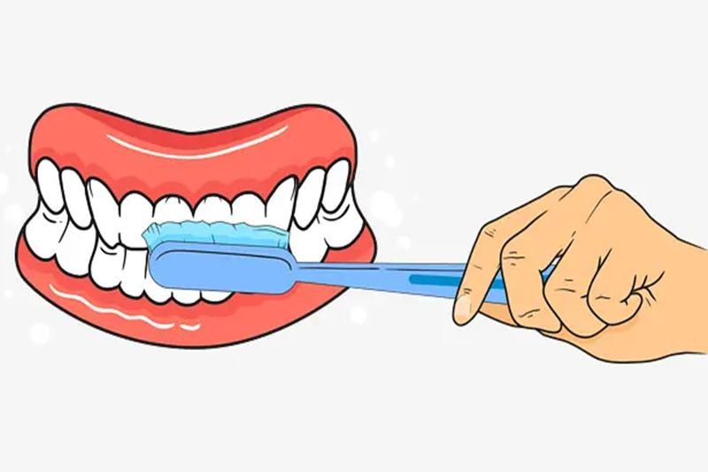 齿间清洁是什么？除了刷牙牙齿清洁真的有必要吗？