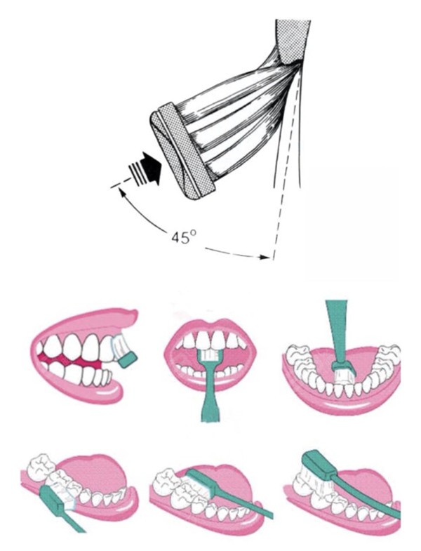 巴氏刷牙法具体操作流程