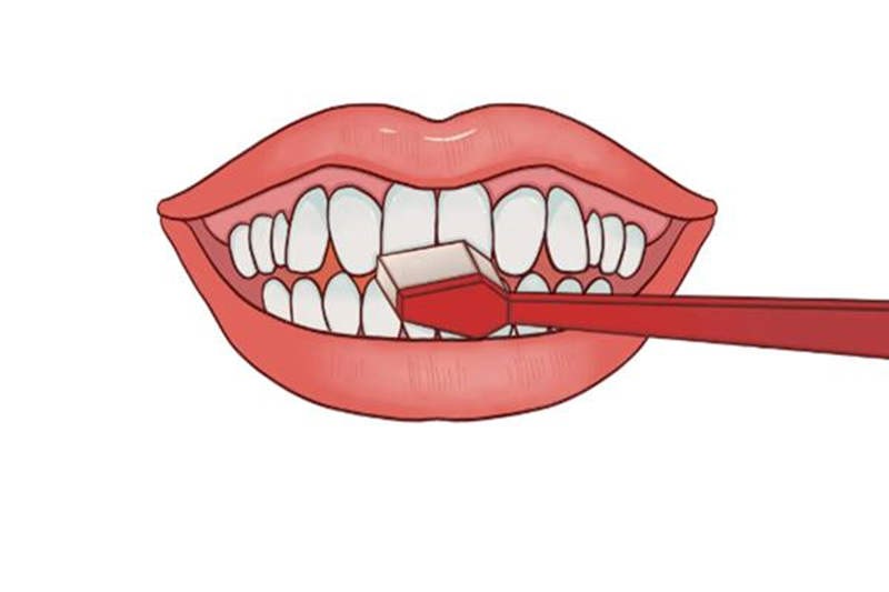 在第34个爱牙日告诉你：为什么天天刷牙还会得牙病