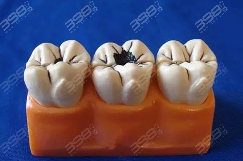 牙缝里面的残留物特别臭是什么原因？快来看看如何清除这些牙垢