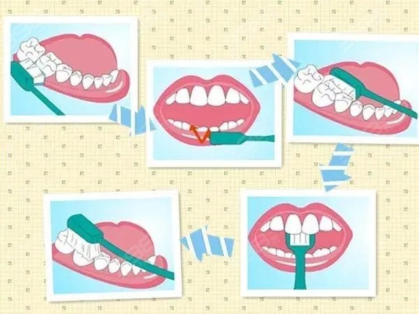 什么是三三刷牙法则