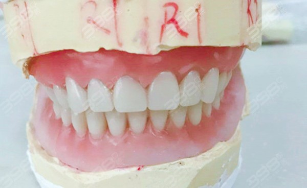 牙龈萎缩戴吸附性义齿有用吗
