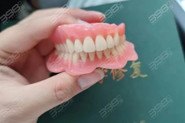 全口牙齿缺失吸附性义齿和种植牙哪个好