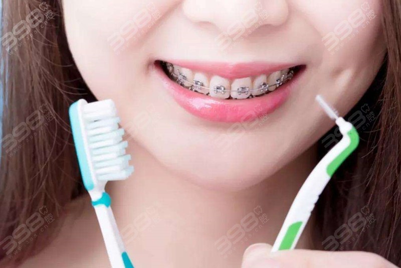 佩戴牙套期间使用哪种牙刷