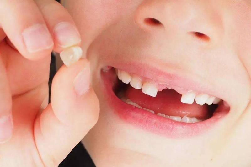 孩子乳牙迟早会掉，还有必要防蛀吗？