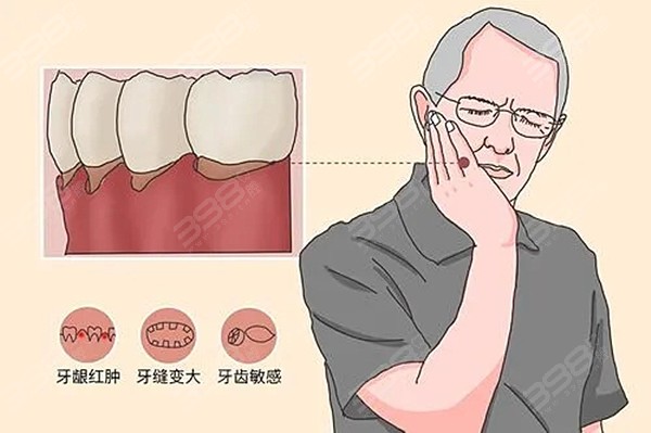 年龄增长导致牙龈问题