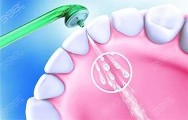 水牙线能代替洗牙吗