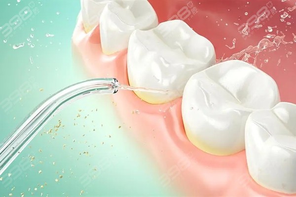 水牙线能代替洗牙吗