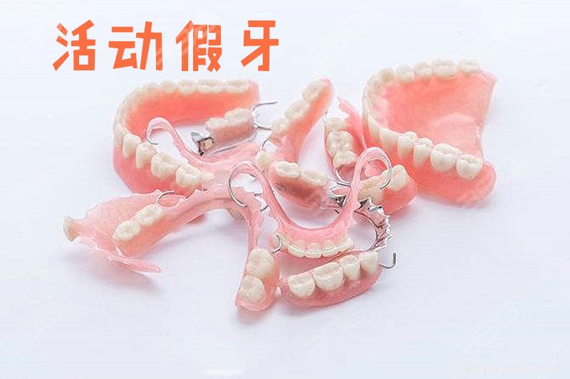 镶牙—活动假牙