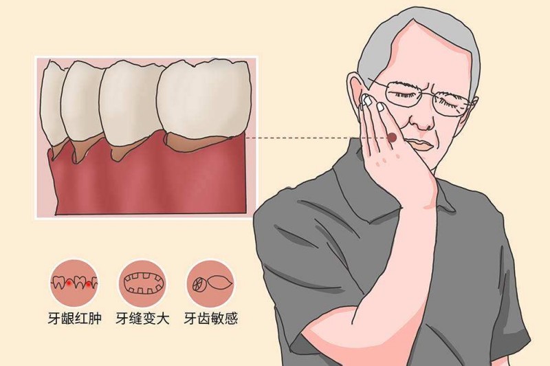 烤瓷牙会引发牙龈萎缩吗？烤瓷牙的危害有哪些？