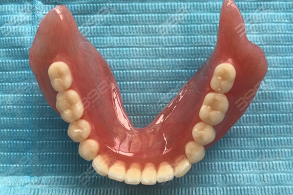 传统义齿和吸附性义齿的区别