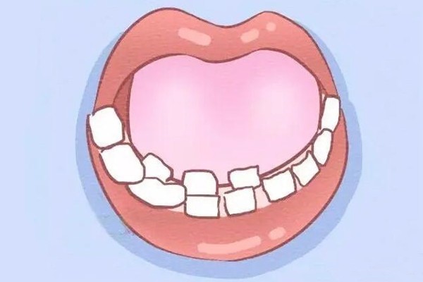 为什么孩子总长双排牙？不妨反思自己是不是过于精细化喂养啦！
