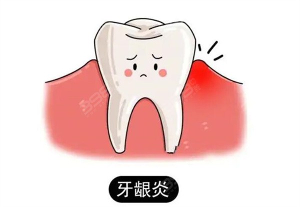 牙龈炎