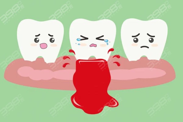 冬季牙龈出血是什么原因？