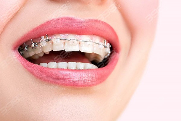 牙齿矫正有年龄限制吗？不矫正有什么影响吗？