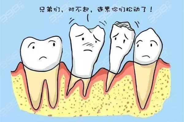 牙周炎一定要拔牙吗