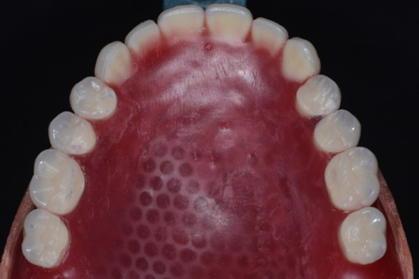 半口活动牙的种类和价格大盘点,看中老年牙齿缺失怎么修复更划算?