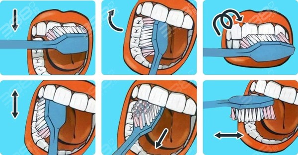 防蛀牙的小方法