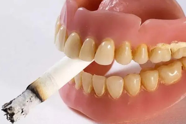 必须给老爸讲下：为什么吸烟对牙齿造成非常大的伤害