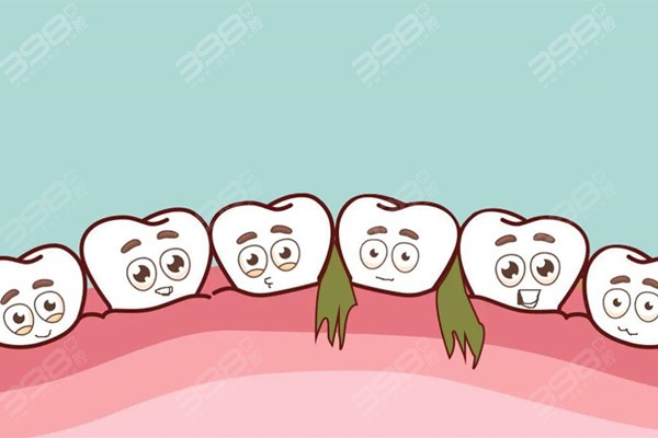 塞牙缝剔不出来,一直疼怎么办?求推荐塞牙缝引起牙疼快速解决方法