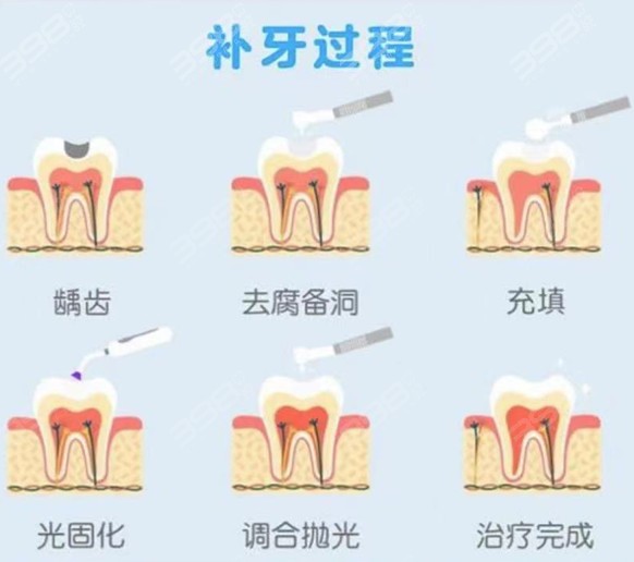 补牙的过程