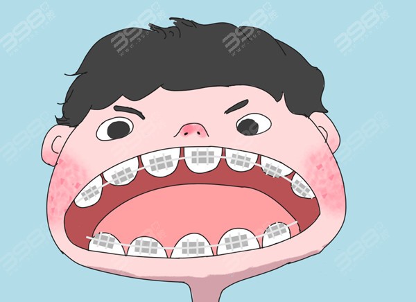 儿童牙齿矫正、补牙、窝沟封闭、拔牙价格表
