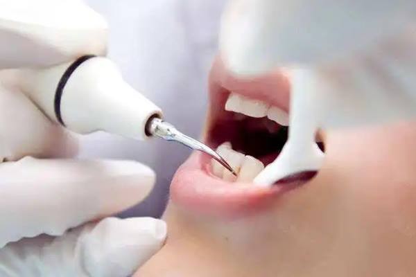 洗牙过程中牙龈出血正常吗？真相和医生洗牙技术有关系吗