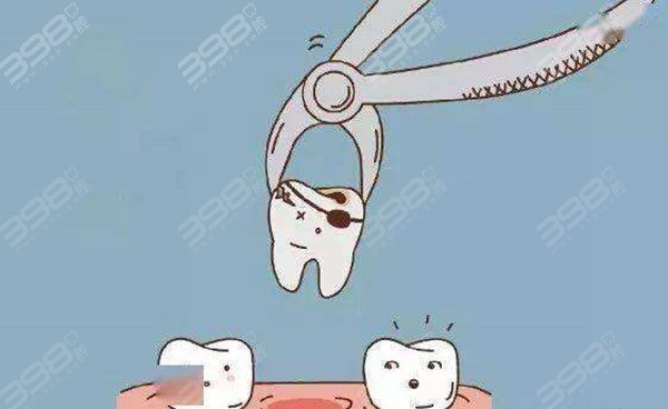 龋齿洞在牙边缘能补吗
