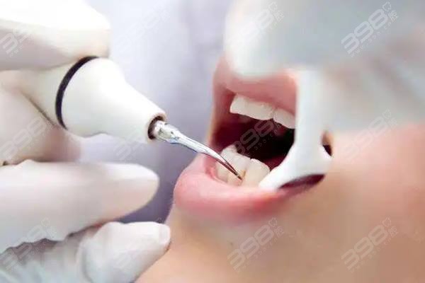 洗牙过程中牙龈出血正常吗