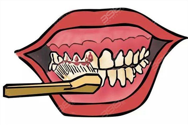 刷牙牙龈出血还能继续刷牙吗？不仅要刷牙正确做法赶快get起来
