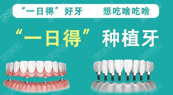 北京昌平区全口种植牙价格表大公开,这几款满口种植牙费用很划算