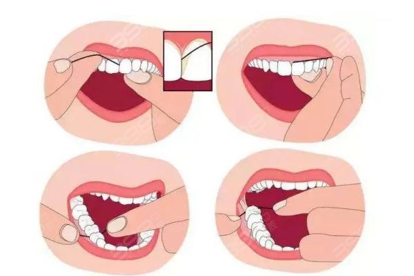 牙线的使用方法是