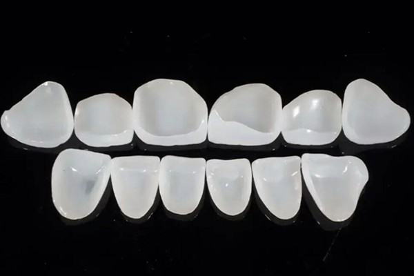 牙贴面拆除对牙有影响吗?刚做完牙贴面显嘴凸,如果拆掉要多少钱?