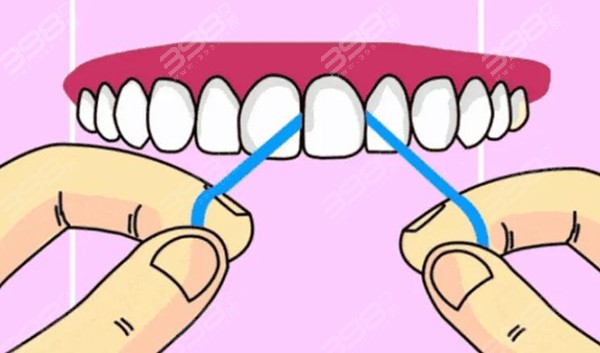 牙线会使牙缝变大吗