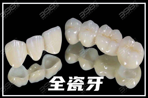 广州全瓷牙修复