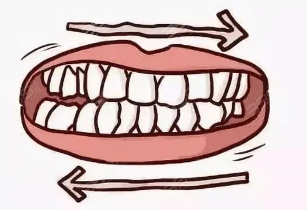 什么是磨牙症？