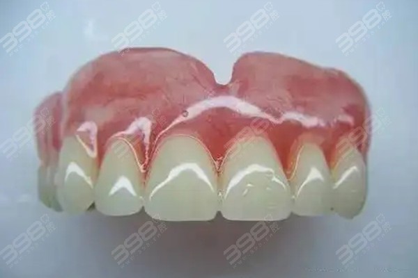2023上海夕阳红牙科全口假牙收费标准