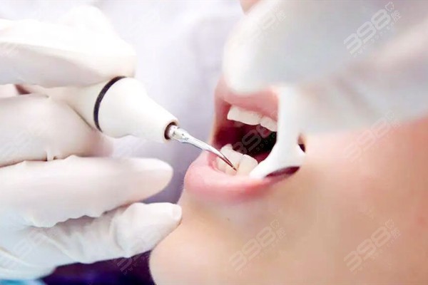 牙博士口腔洗牙多少钱一次
