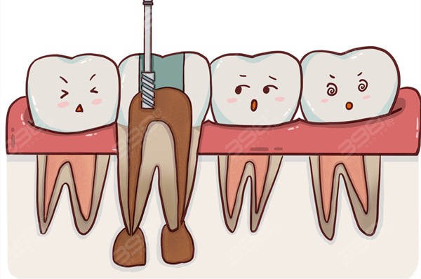 上海黄浦区补牙、拔牙、洗牙、根管治疗费用明细
