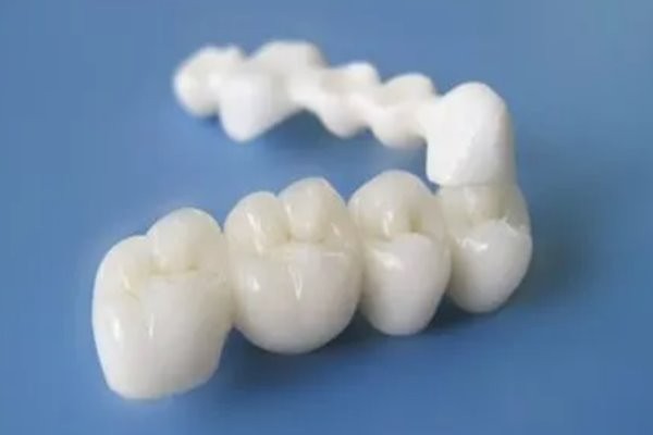 福州全瓷牙价格表新公布，顺道了解福州镶牙正规的医院